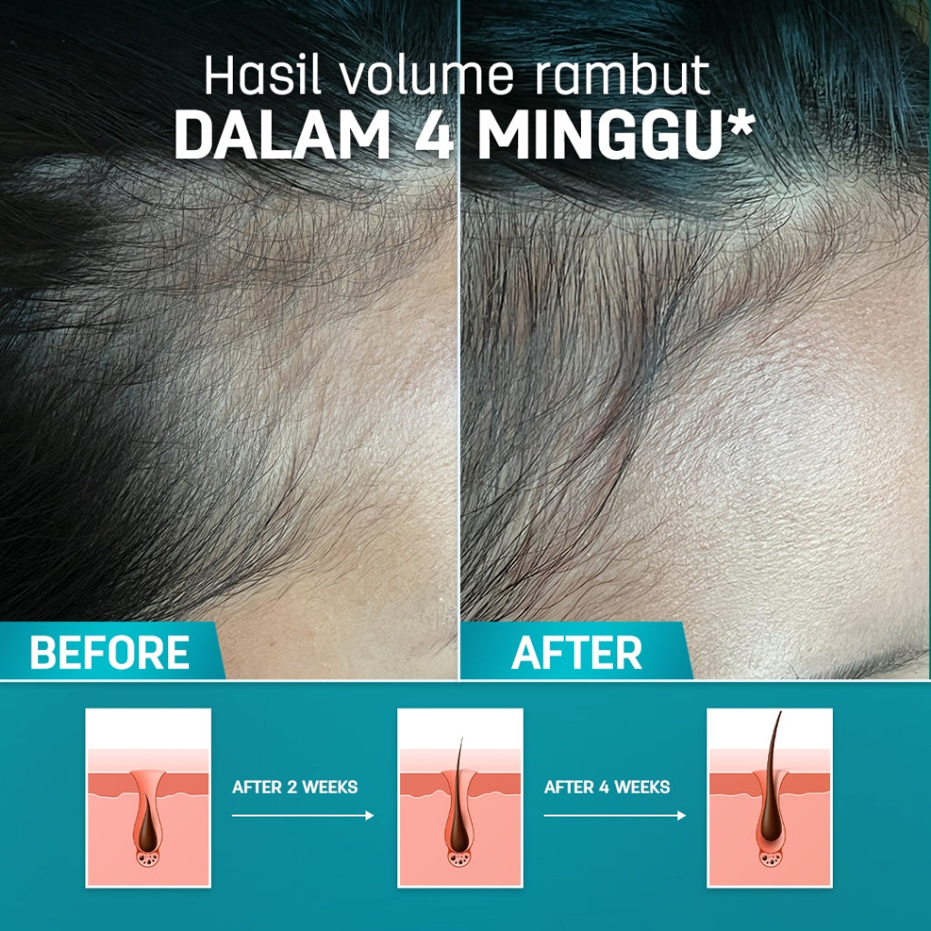 ERHAIR HairGrow Protection Serum 7x8 ml with 1.5% Kopexil - Serum Panax Ginseng Mengurangi Rontok | Serum penumbuh rambut | Menjaga Kesehatan Kulit Kepala dan Menguatkan Akar