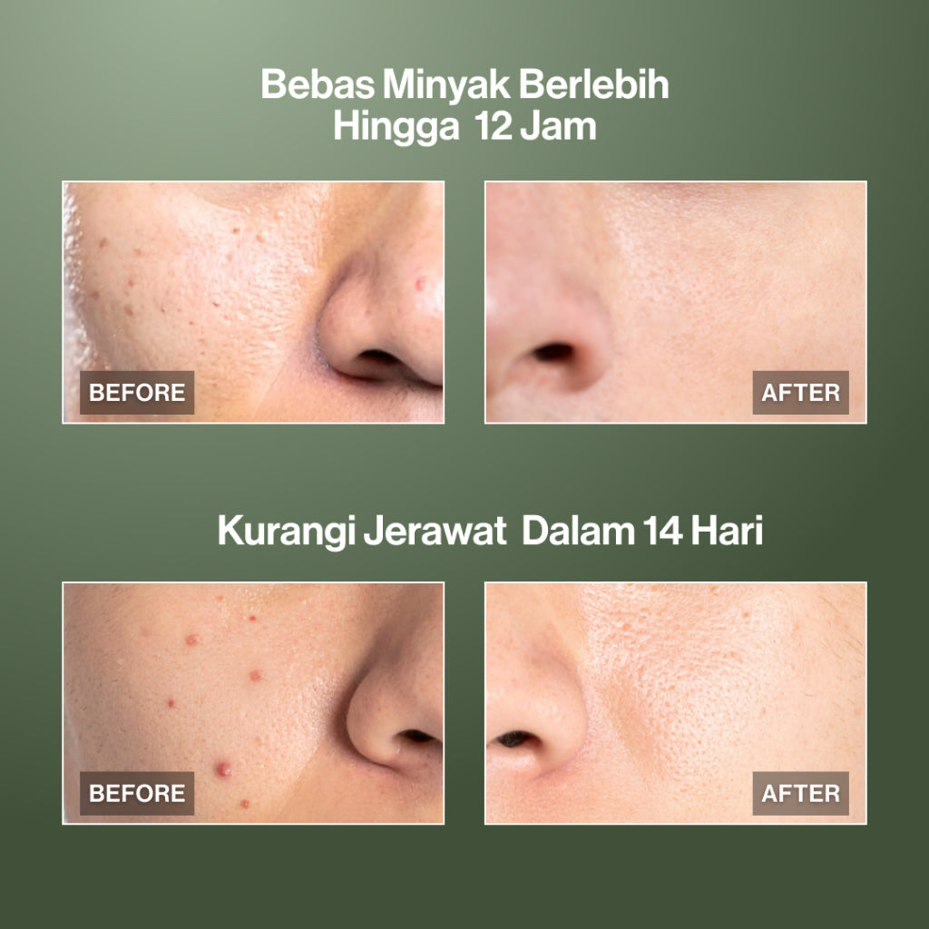 Twin Pack Kahf Face Wash Oil and Acne Care 100 ml - 2 pcs Sabun Cuci Muka Pria untuk Membantu Lawan Jerawat dan Kontrol Minyak - Suitable for Daily Use