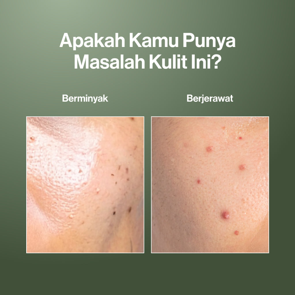 Twin Pack Kahf Face Wash Oil and Acne Care 100 ml - 2 pcs Sabun Cuci Muka Pria untuk Membantu Lawan Jerawat dan Kontrol Minyak - Suitable for Daily Use