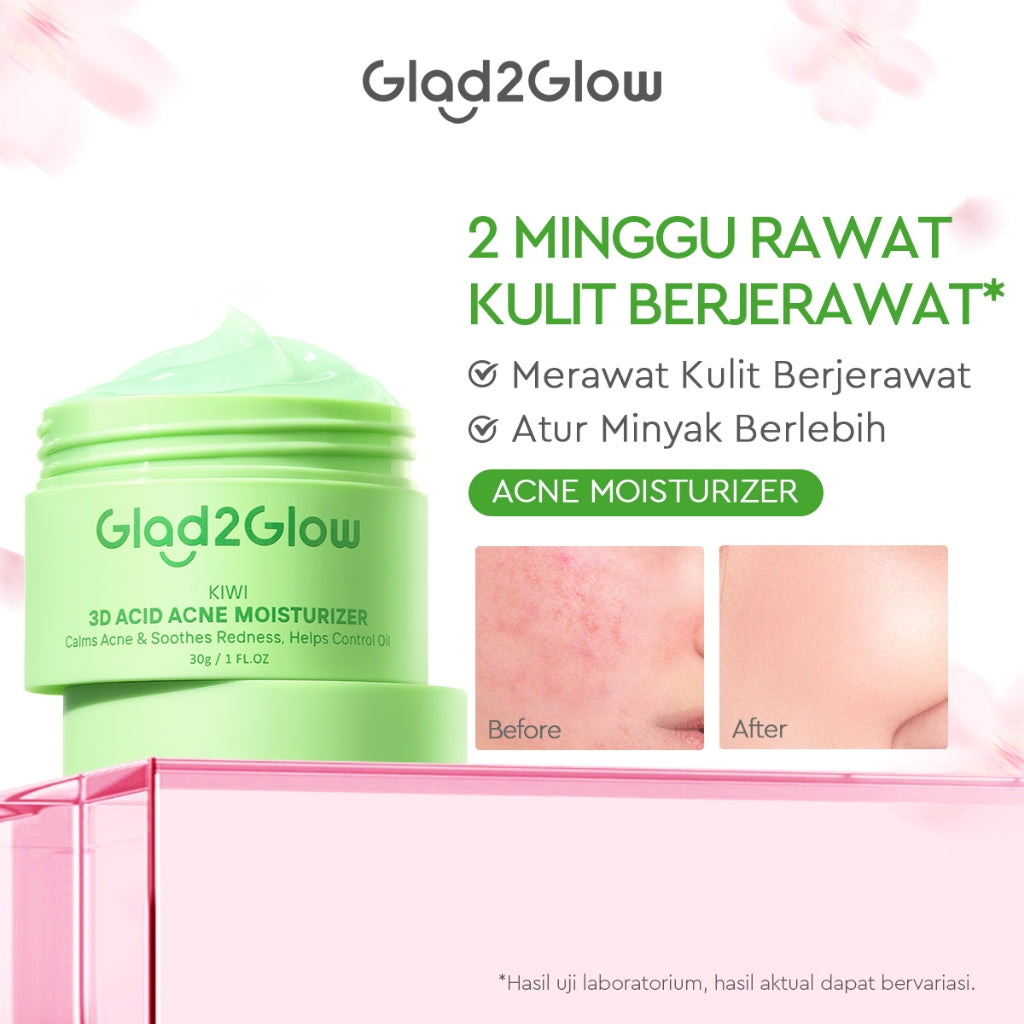 Glad2Glow Moisturizer Series Mencerahkan Pencerah Wajah Anti Jerawat Penuaan Hilangkan Flek Tenangkan Kulit Niacinamide 377 Retinol Centella Skincare Pelembab Esensi Perawatan Kulit Pelembab Wajah Pembersih day cream tone up g2g official store