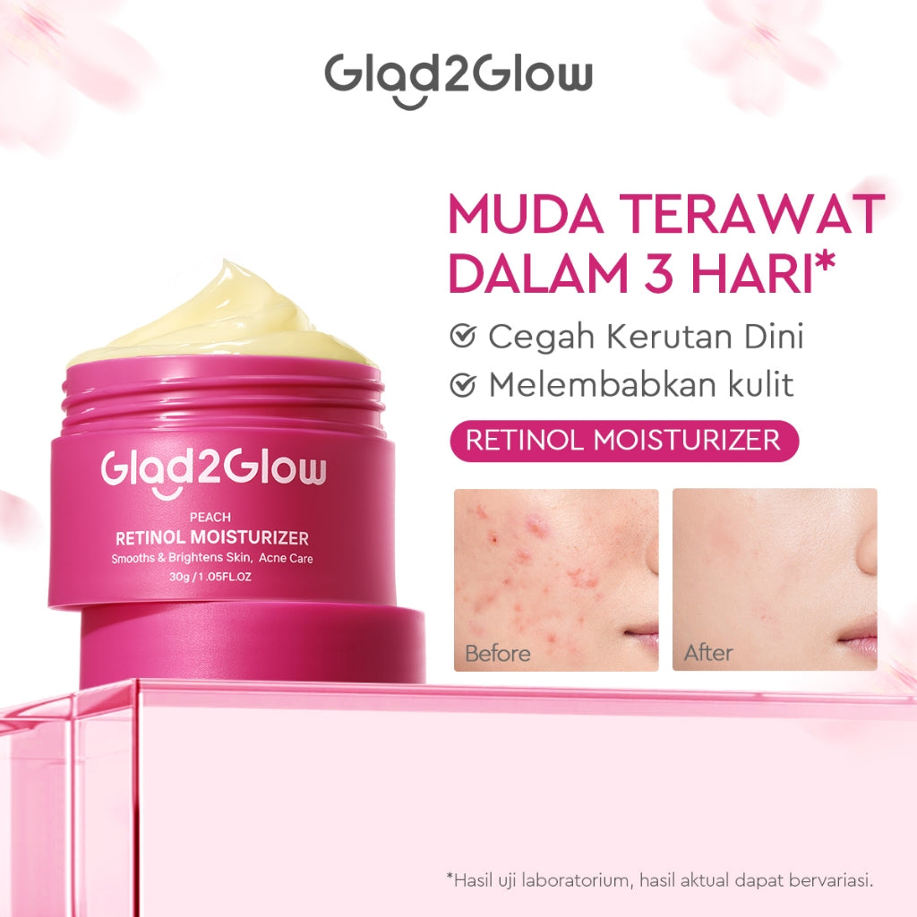 Glad2Glow Moisturizer Series Mencerahkan Pencerah Wajah Anti Jerawat Penuaan Hilangkan Flek Tenangkan Kulit Niacinamide 377 Retinol Centella Skincare Pelembab Esensi Perawatan Kulit Pelembab Wajah Pembersih day cream tone up g2g official store