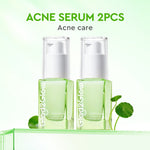 Glad2Glow Serum Series Peeling Serum Exfoliating Serum Bright Serum Glad2Glow Serum Mencerahkan Wajah Serum Pemutih Wajah Serum Retinol Serum Dark Spot Serum Acne Spot Serum Jerawat Glowing Serum Whitening Serum Brightening Serum Glow G2G Serum Niacinamid