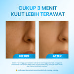 [  ] Cleora 3 Minutes Exfoliating Peeling Gel - Exfoliasi Wajah With AHA BHA PHA Untuk Wanita Pria Membantu Mengangkat Sel Kulit Mati Kotoran Skincare Face Scrub Niacinamide Eksfoliasi Muka Brightening Scincare Mencerahkan Komedo Acne Day Night