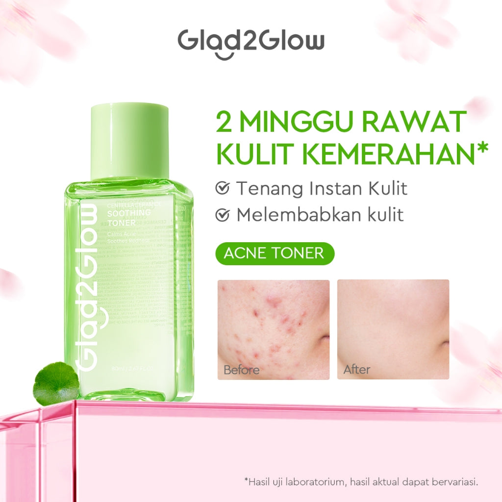 [Hemat 5PCS]Glad2Glow Toner Complete Series-Brightening/Acne care/Barrier/Exfoliating-Skincare toner badan face mist hydrating toner centella toner wajah eksfoliasi water toner hydrating gloglowing brightening exfoliasi glycolic g2glow official store