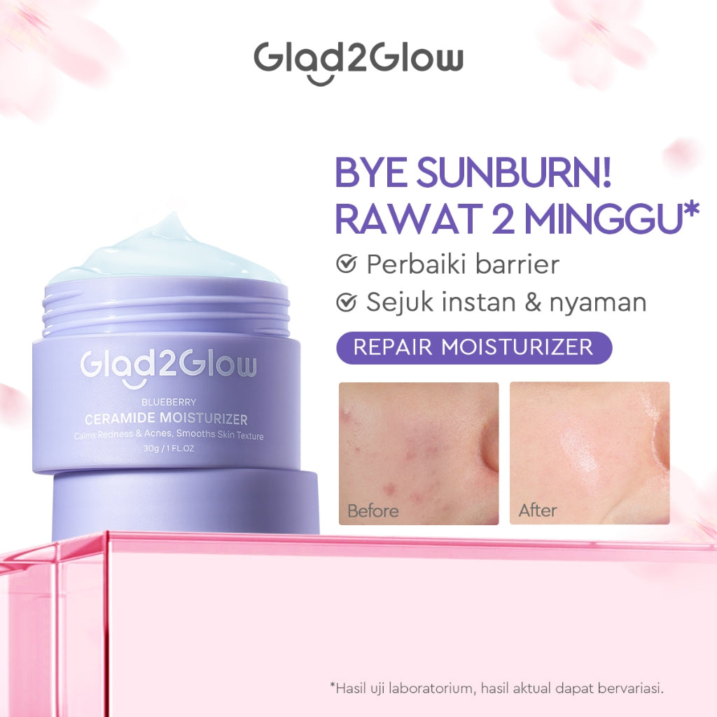 Glad2Glow Moisturizer Series Mencerahkan Pencerah Wajah Anti Jerawat Penuaan Hilangkan Flek Tenangkan Kulit Niacinamide 377 Retinol Centella Skincare Pelembab Esensi Perawatan Kulit Pelembab Wajah Pembersih day cream tone up g2g official store