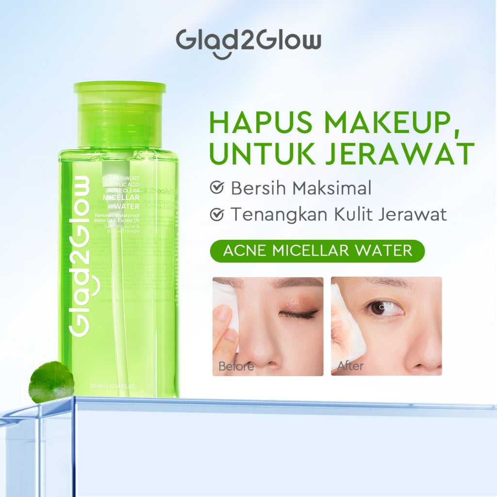[READY STOCK]Glad2Glow Micellar Water 300ml cleansing oil cleansing balm micellar centella salycilic acid remover pembersih double cleansing pembersih make up make up remove cleanface facial  Menghilangkan jerawat Penghapus riasan g2glow official store