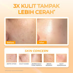 【5pcs Hemat】(REAL 10% ADVANCE NIACINAMIDE) Hanasui Power Bright Expert Serum - Mencerahkan, Kurangi Bintik Hitam Bekas Jerawat