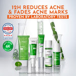 [NEW] YOU AcnePlus 2% BHA Fight Acne Serum Jerawat Kulit Berminyak Berjerawat Salicylic Acid Serum