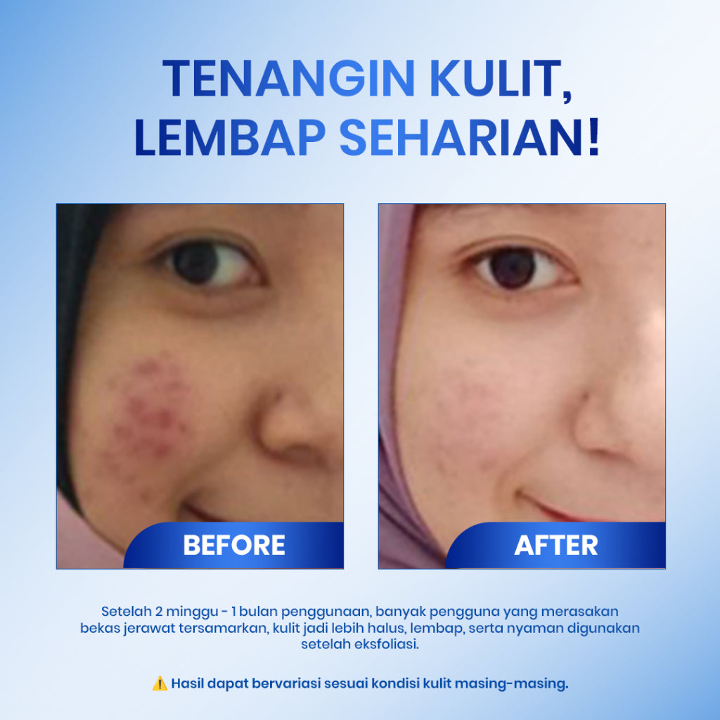 [2IN1 HEMAT] Cleora Brightening Set - Skincare Red Saviour + 8x Hyalu Moisturizer Paket Peeling Solution Eksfoliasi Wajah Pemutih Dark Spot Wanita Pria Serum Jerawat Scincare Exfoliasi Jerawat Acne Mosturizer Mencerahkan Pelembab Cream Muka Kering BPOM