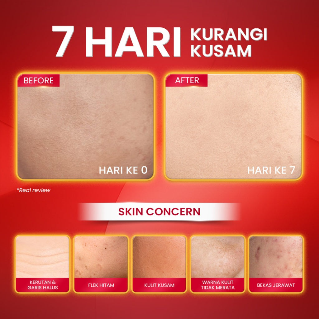 Hanasui Power Retinol Expert Serum 20ml - 1% Encapsulated Retinol - Cegah Kerutan & Kurangi Kusam