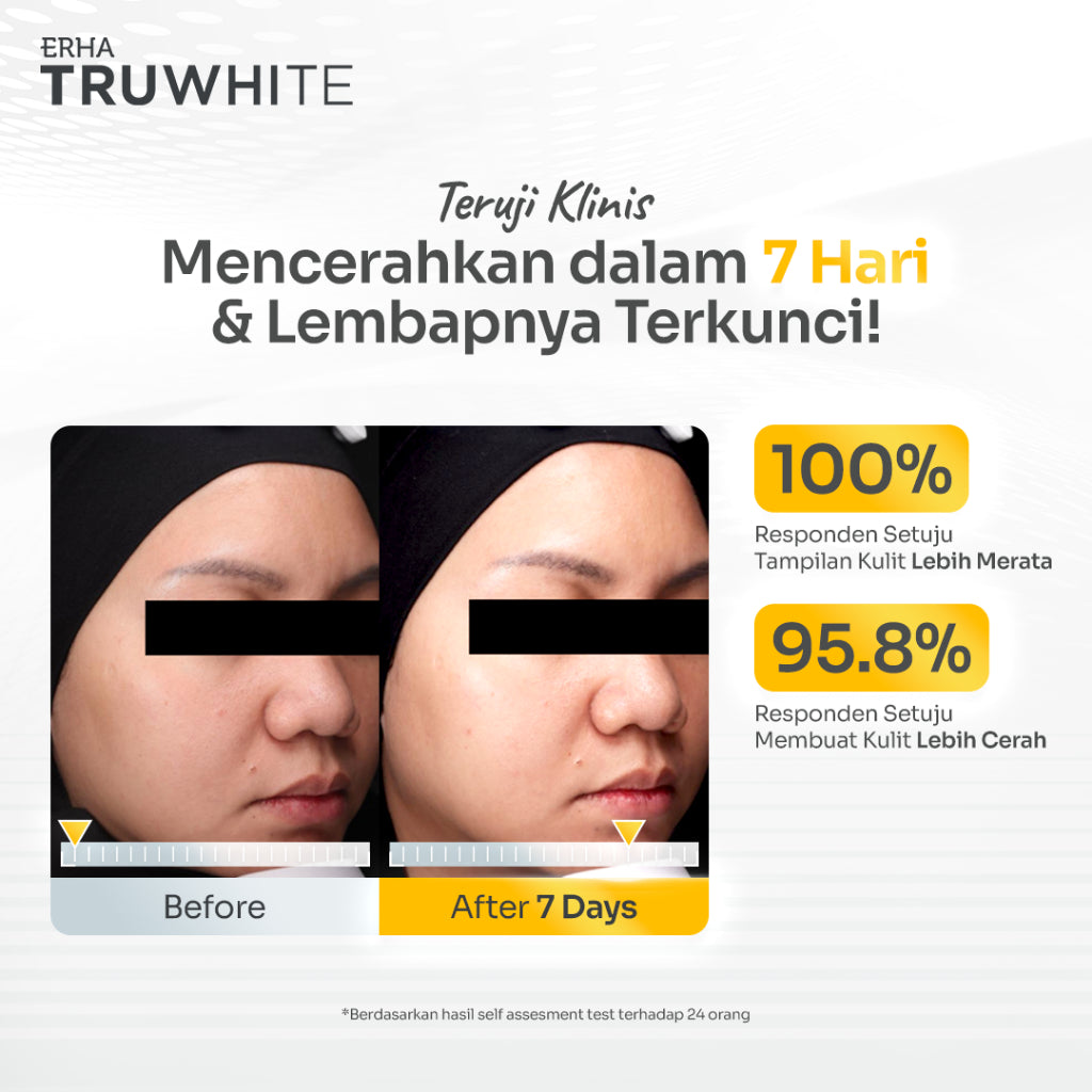 ERHA Truwhite Peptovitae® Bright,  Yuzu Extract & Niacinamide Moisture Gel Cream - 30 g I Brightening Moisturizer untuk Mencerahkan Wajah Dalam 7 Hari