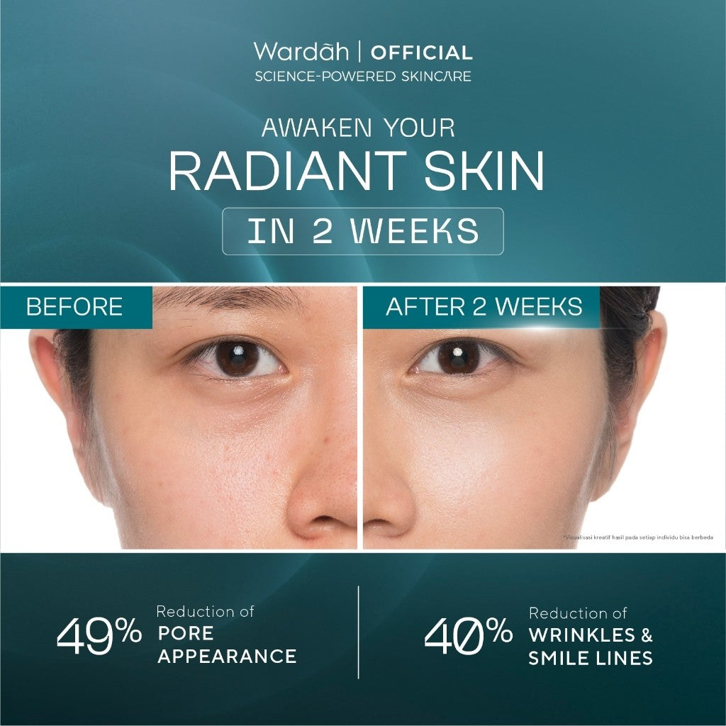 Wardah Retinal Liposome Cysteamine Radiant Resurfacing Serum 30ml/Serum Wajah
