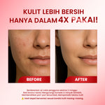 [PAKET HEMAT ISI 2] Cleora Peeling Solution Serum - Red Saviour Special Bundle Eksfoliasi Wajah Berminyak Mencerahkan Muka Kusam Paket Skincare 1 Set Lengkap Pria Dan Wanita Niacinamide Exfoliasi Scincare Mengatasi Dark Spot Mengangkat Sel Kulit Mati BPOM