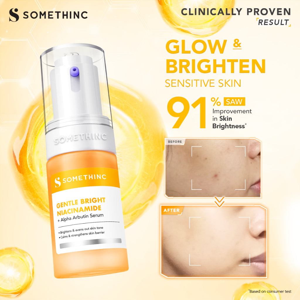 [BARU!] SOMETHINC Gentle Bright Niacinamide + Alpha Arbutin Serum - Pencerah Wajah Untuk Semua Jenis Kulit | Memperkuat Skin Barrier, Meratakan Warna Kulit, dan Memudarkan Noda Gelap & Memudarkan Pori Pori, Serum untuk Kulit Sensitif