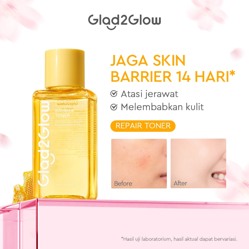 [Hemat 5PCS]Glad2Glow Toner Complete Series-Brightening/Acne care/Barrier/Exfoliating-Skincare toner badan face mist hydrating toner centella toner wajah eksfoliasi water toner hydrating gloglowing brightening exfoliasi glycolic g2glow official store