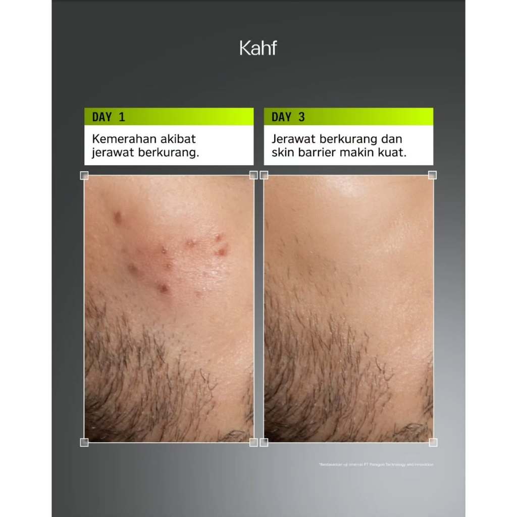 [NEW! BEBAS JERAWAT TANPA RASA KETARIK] Kahf Acne Care Amino Gel Face Wash 100 ml – Sabun Cuci Muka Pria Kulit Sensitif & Berjerawat dengan Hypochlorous Acid, Panthenol, Succinic Acid, Glycerin – Gentle Cleanser Low pH untuk Daily Use