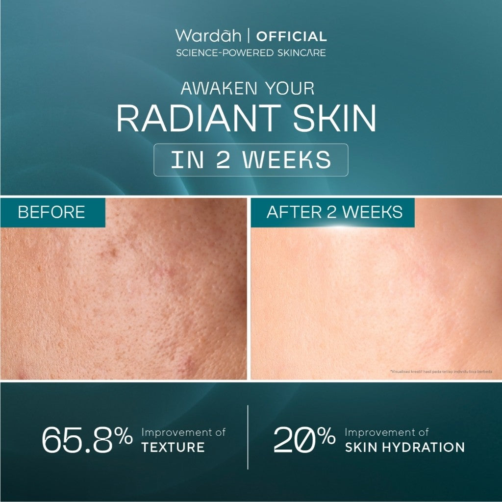 Wardah Retinal Liposome Cysteamine Radiant Resurfacing Serum 30ml/Serum Wajah