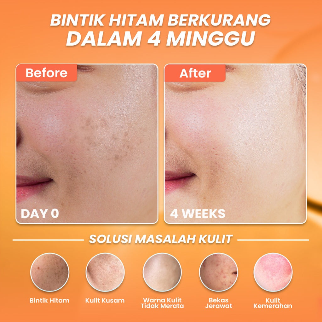 【5pcs Hemat】Hanasui Serum Vitamin C - Mencerahkan & Pudarkan Bintik Hitam 2% Vitamin C 2% Niacinamide 1% Betaine