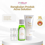 Jglow Skincare Paket Kulit Berjerawat Acne (Perawatan Kulit Bejerawat) - 4pcs
