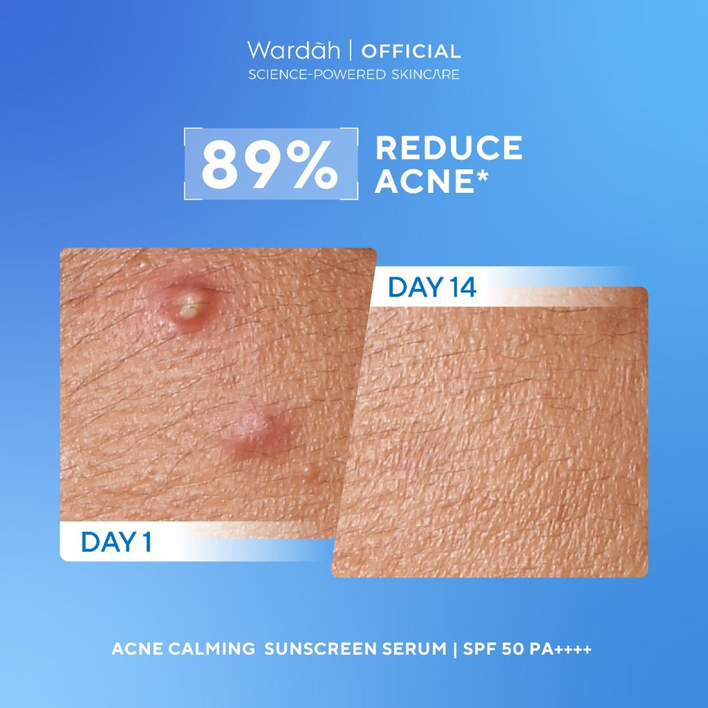 WARDAH UV Shield Acne Calming Sunscreen Serum SPF 50 PA 25ml 40 ml 100ml Sunscreen Wajah Meredakan Jerawat Ringan Mudah Meresap Calming and Repair Boosting Skincare
