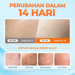 [NEW] HANASUI Bright Expert Moisturizer Gel 30g - Pelembab Gel Bening Lembap & Mencerahkan - 5% Advance Niacinamide & Tranexamic Acid - Ratakan warna kulit & Kurangi Bintik Hitam