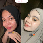 GLOGLOWING Glowing Night Acne Booster 10g