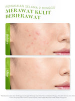 Glad2Glow Centella Water Gel Soothing Moisturizer Madeca Cream Berjerawat Acne Cica Pelembab Wajah 100g  Menenangkan kulit Mengurangi kemerahan Mengontrol minyak Mengobati kulit berjerawat Menjaga g2glow official store
