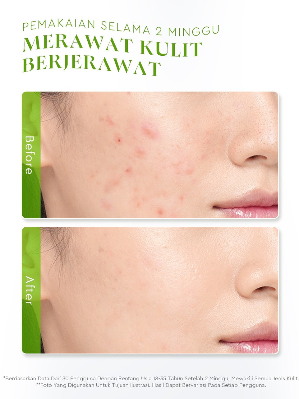 Glad2Glow Centella Water Gel Soothing Moisturizer Madeca Cream Berjerawat Acne Cica Pelembab Wajah 100g  Menenangkan kulit Mengurangi kemerahan Mengontrol minyak Mengobati kulit berjerawat Menjaga g2glow official store