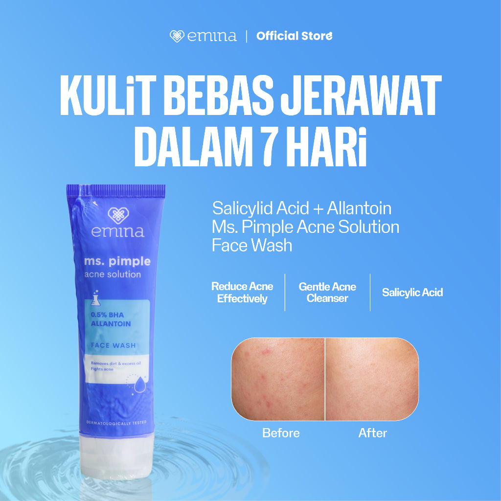 Emina Ms. Pimple Acne Solution Face Wash 50 ml - Pembersih Wajah Kulit Berjerawat