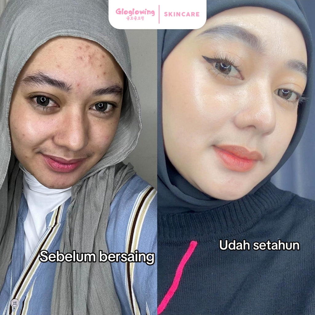 GLOGLOWING Ectoin+ Extra Glowing Booster 30G