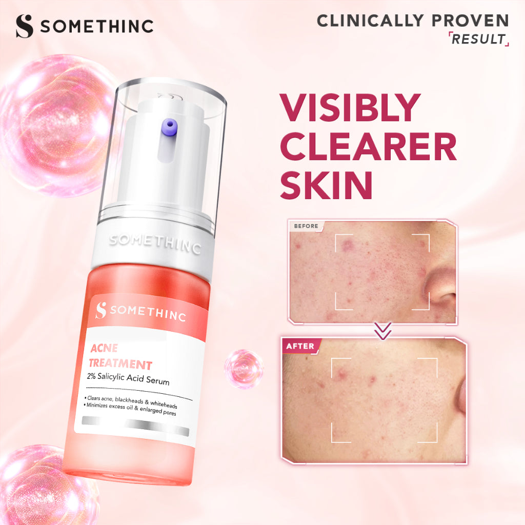 SOMETHINC - Serum Series | Glass-C 12% Vitamin C+ | Gentle Bright Niacinamide | Advanced Peeling 20% AHA BHA | Level 1% Retinol | Calm Down Skinpair Barrier | Diamond Glow Phyto | Hyaluronic9+ Advanced | wajah cerah no dark Spot Age Spot Freckles Glowing