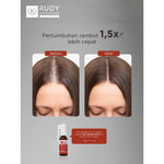 Rudy Hadisuwarno Cosmetics Hair Growth Serum 30 ml Hair Serum Penumbuh Rambut Mengurangi Rambut Rontok