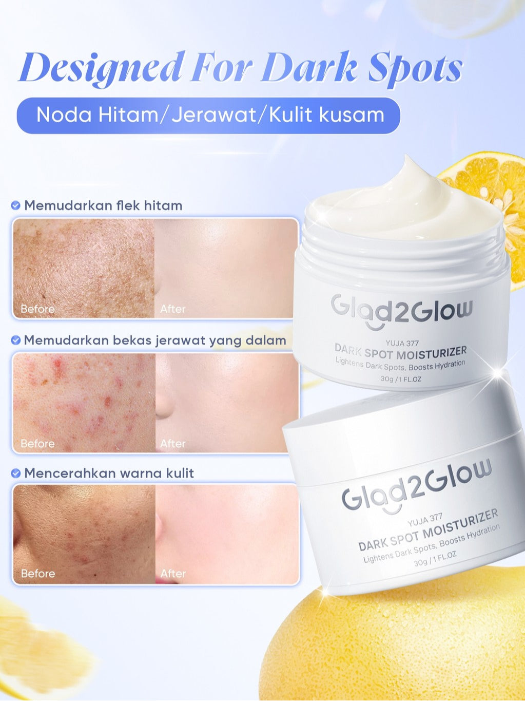 [ORDER NOW, HEMAT 30K]Glad2Glow Symwhite377 Dark Spot Bundle 7PCS-Yuja Skincare Cerah Brightening Moisturizer+Dark Spot Serum+Cleanser+Retinol Moisturizer+ Retinol Serum+Toner+Clay Stick Meringankan flek hitam mencerahkan warna kulit g2glow official store