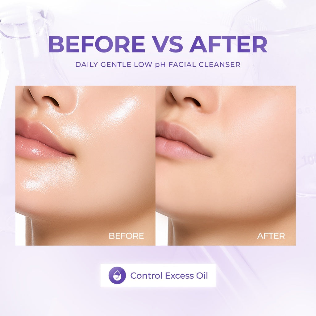 ELFORMULA Daily Gentle Low pH Facial Cleanser - Face Wash Facewash Sabun Cuci Muka Acne-Prone Kulit Berminyak Oil Control Pembersih Wajah Glowing Mencerahkan Melembabkan Wajah Niacinamide Calendula Cica