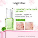 Glad2Glow Serum Series Peeling Serum Exfoliating Serum Bright Serum Glad2Glow Serum Mencerahkan Wajah Serum Pemutih Wajah Serum Retinol Serum Dark Spot Serum Acne Spot Serum Jerawat Glowing Serum Whitening Serum Brightening Serum Glow G2G Serum Niacinamid