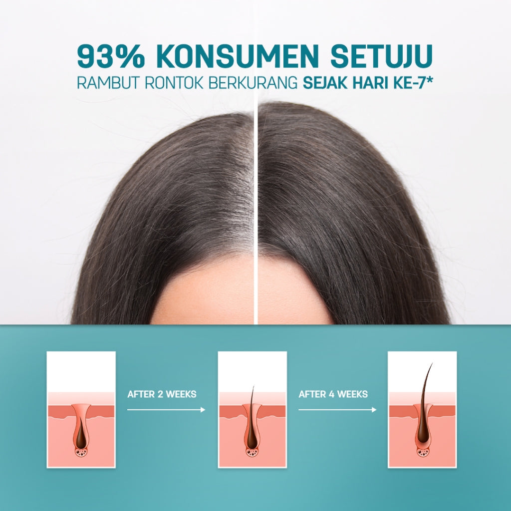 [BEST SELLER TONIK RONTOK] ERHAIR Twinflame HairGrow Tonic with Kopexil 60ml - Tonic Keratin & Biotin Rambut Mengurangi Rontok  Menjaga Kesehatan Kulit Kepala dan Menguatkan Akar
