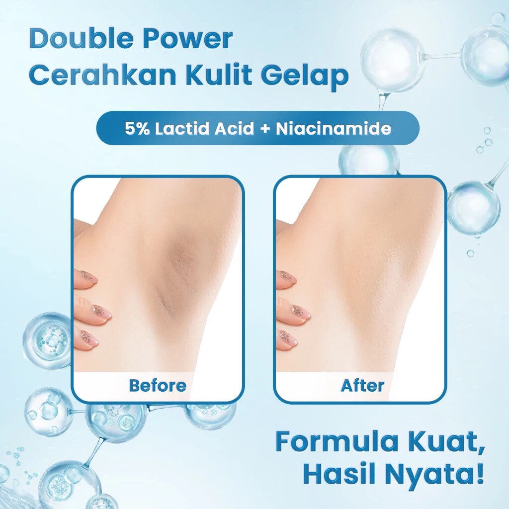 Milk Recipe Brightening Body Toner – Toner Pencerah badan pencerah ketiak pencerah leher body exfoliasi AHA & Niacinamide, Mencerahkan Leher & Siku, Kulit Belang & Gelap, Penghilang Noda Hitam & Bekas Jerawat Badan