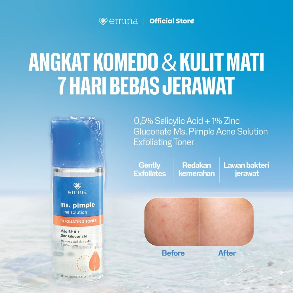 Emina Ms. Pimple Acne Solution Exfoliating Toner 100 mL - Angkat Sel Kulit Mati dan Komedo, Atasi Jerawat dalam 7 Hari!