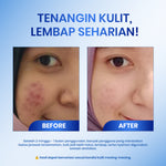 [PAKET HEMAT 2PCS] CLEORA 8x Hyalu Hydrating Moisturizer - Pelembab Muka Kering Dan Mengatasi Kusam Skincare Gel Untuk Mencerahkan Menenangkan Dark Spot Whitening Mosturizer Skin Barrier Calming Brightening Wajah Jerawat Acne Day Cream Pria Wanita BPOM