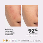 NONI SERUM - NPURE NONI PROBIOTICS HYPOALLERGENIC “CALM ME DOWN” SENSITIVE FACE SERUM / Serum Wajah Hypoallergenic Sensitif Kemerahan / Semua Jenis Kulit / Ceramide