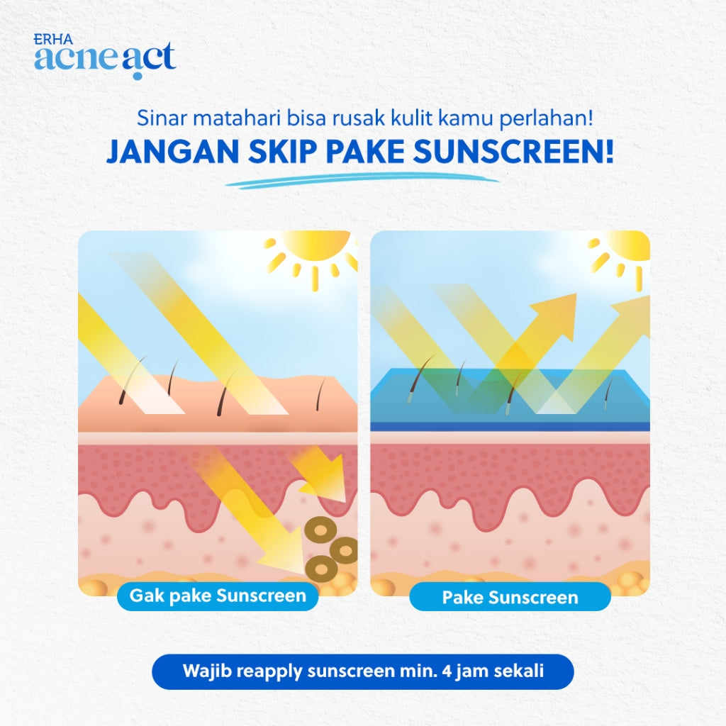 ERHA Acneact Acne Protection & Oil Control Sunscreen SPF 45+++ 30 g Sunscreen Jerawat Niacinamide