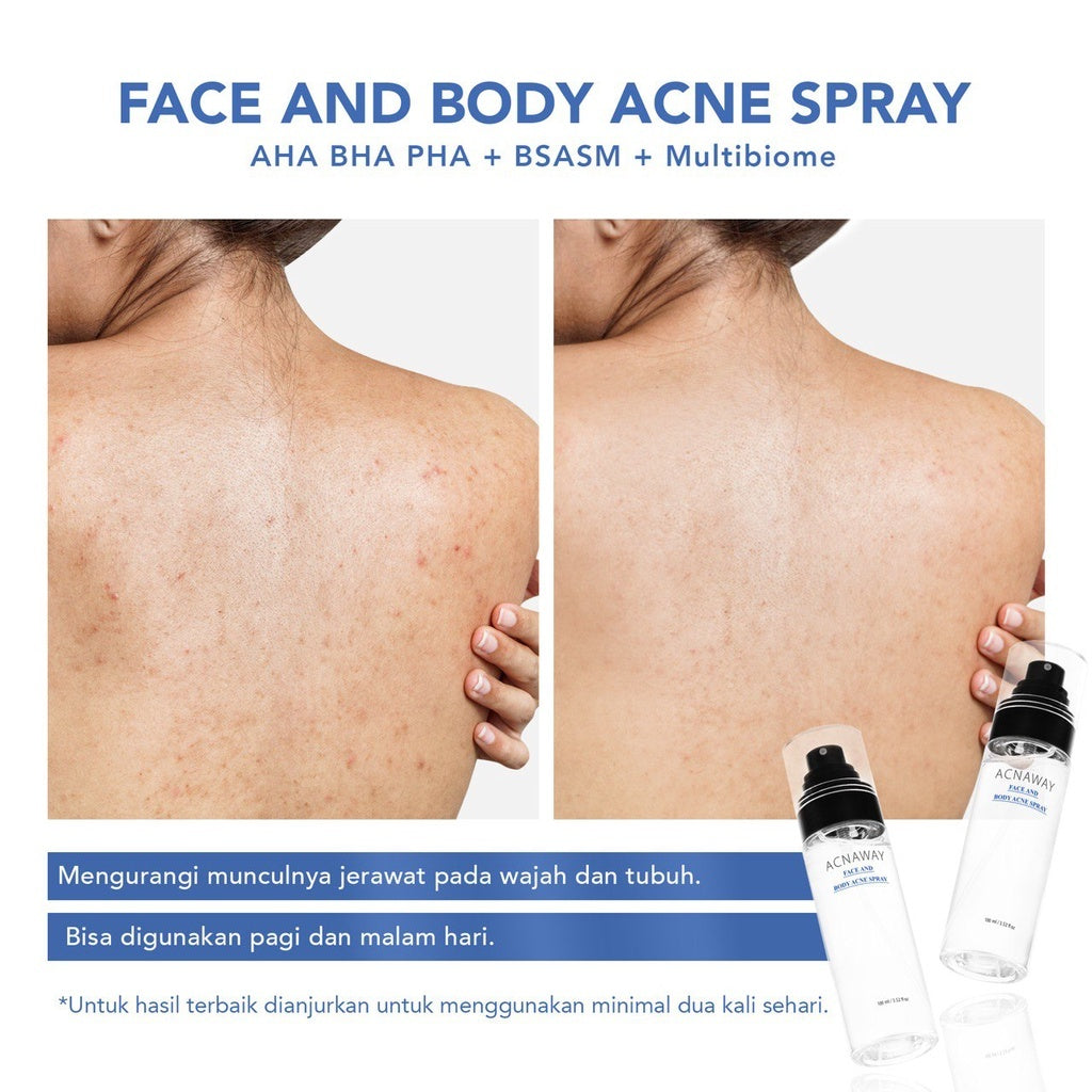 ACNAWAY Bundle 2 in 1 Acne Face & Body Spray + Acne Sun Serum – Spray Anti Jerawat & Sunscreen untuk Kulit Berjerawat