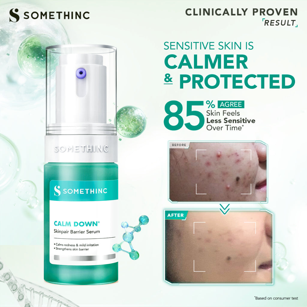 SOMETHINC - Serum Series | Glass-C 12% Vitamin C+ | Gentle Bright Niacinamide | Advanced Peeling 20% AHA BHA | Level 1% Retinol | Calm Down Skinpair Barrier | Diamond Glow Phyto | Hyaluronic9+ Advanced | wajah cerah no dark Spot Age Spot Freckles Glowing