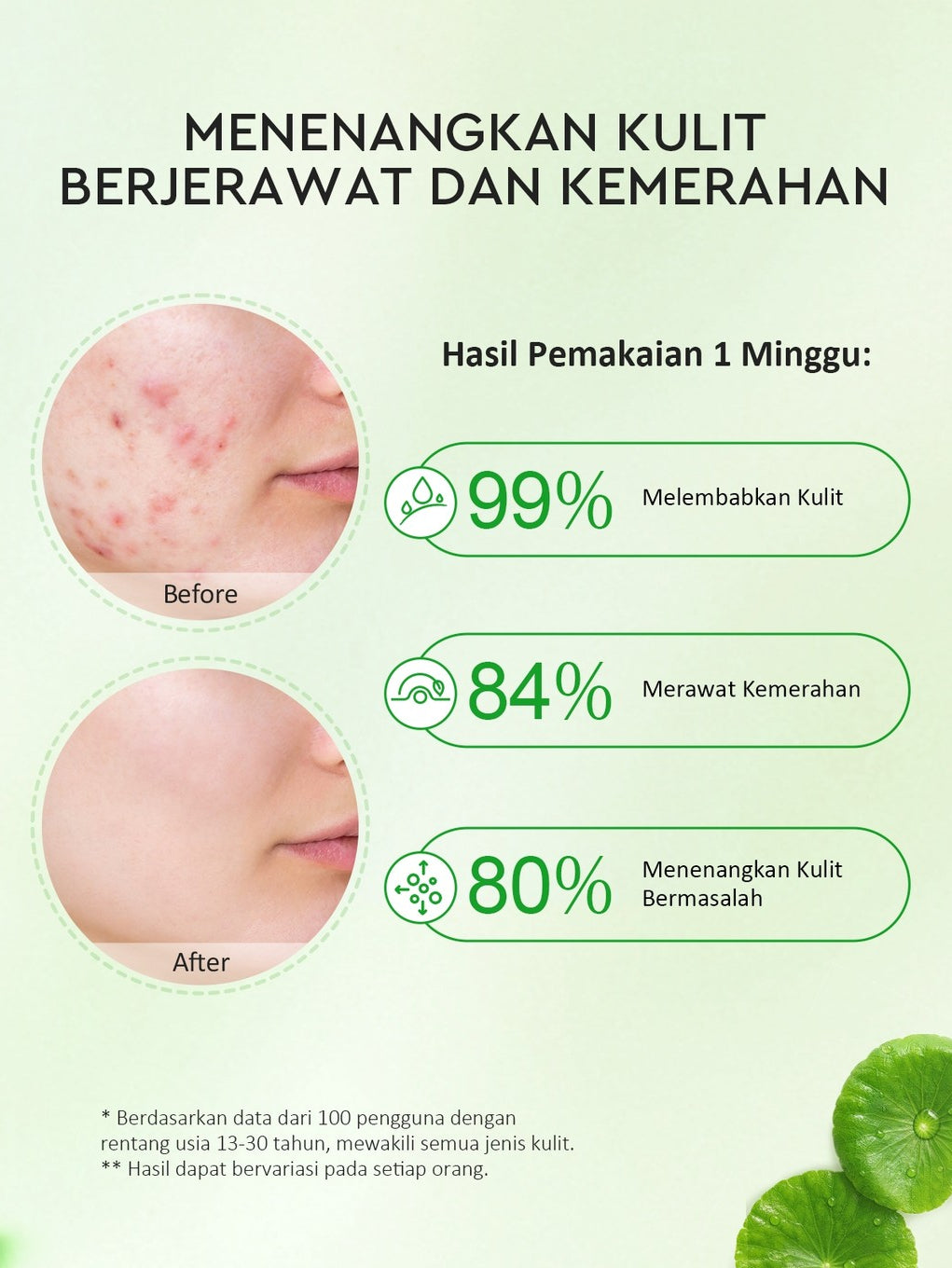 Glad2Glow Centella Water Gel Soothing Moisturizer Madeca Cream Berjerawat Acne Cica Pelembab Wajah 100g  Menenangkan kulit Mengurangi kemerahan Mengontrol minyak Mengobati kulit berjerawat Menjaga g2glow official store