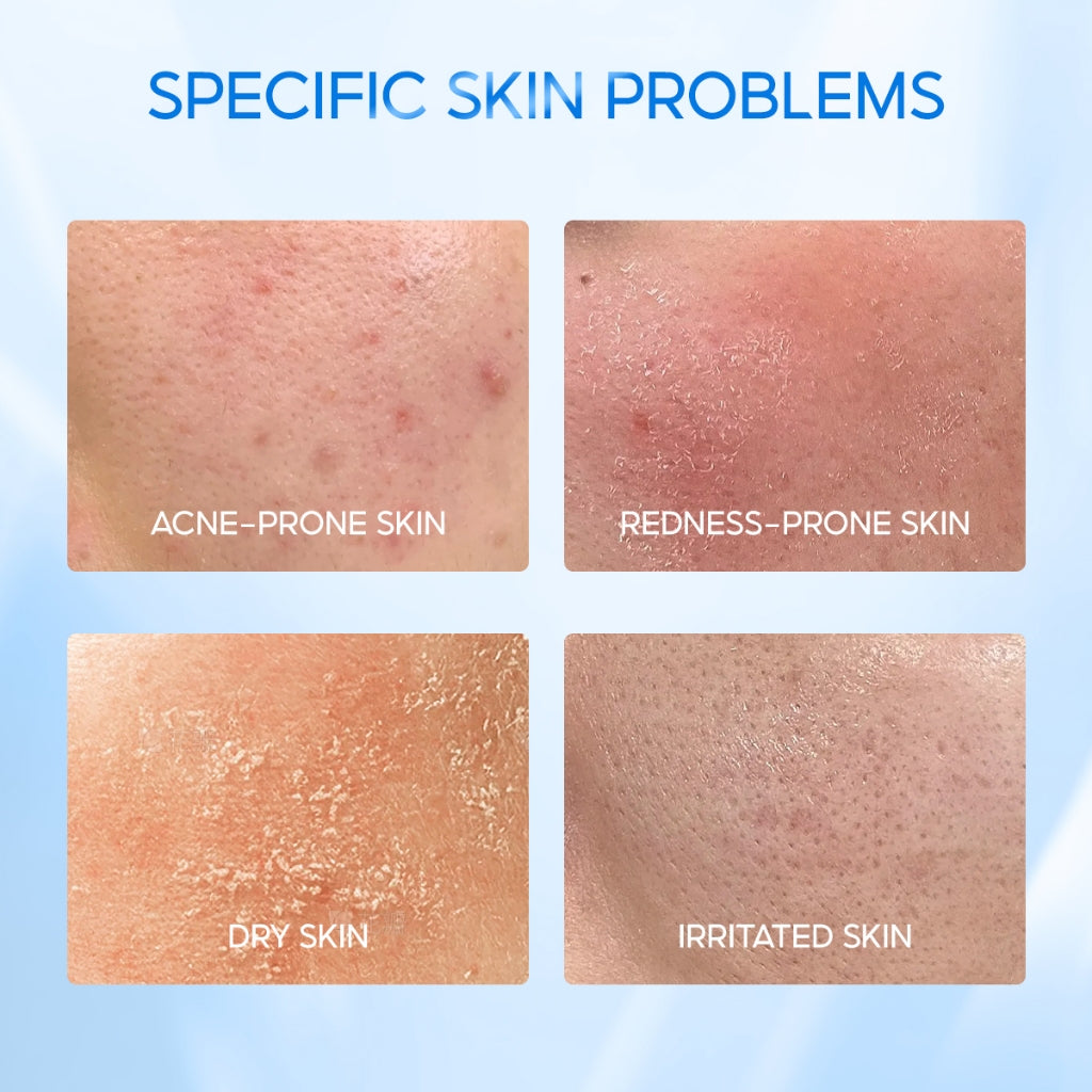 ELFORMULA Intensive CeraHydro Barrier Repair Moisture Gel - Moisturizer Calming Pelembab Wajah Pagi Malam Kulit Cerah Skin Barrier Hyaluronic Acid with CeraHydro + Plant Extract & Ceramide Skincare Oil Control Kulit Kering Iritasi