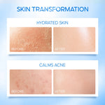 ELFORMULA Intensive CeraHydro Barrier Repair Moisture Gel - Moisturizer Calming Pelembab Wajah Pagi Malam Kulit Cerah Skin Barrier Hyaluronic Acid with CeraHydro + Plant Extract & Ceramide Skincare Oil Control Kulit Kering Iritasi