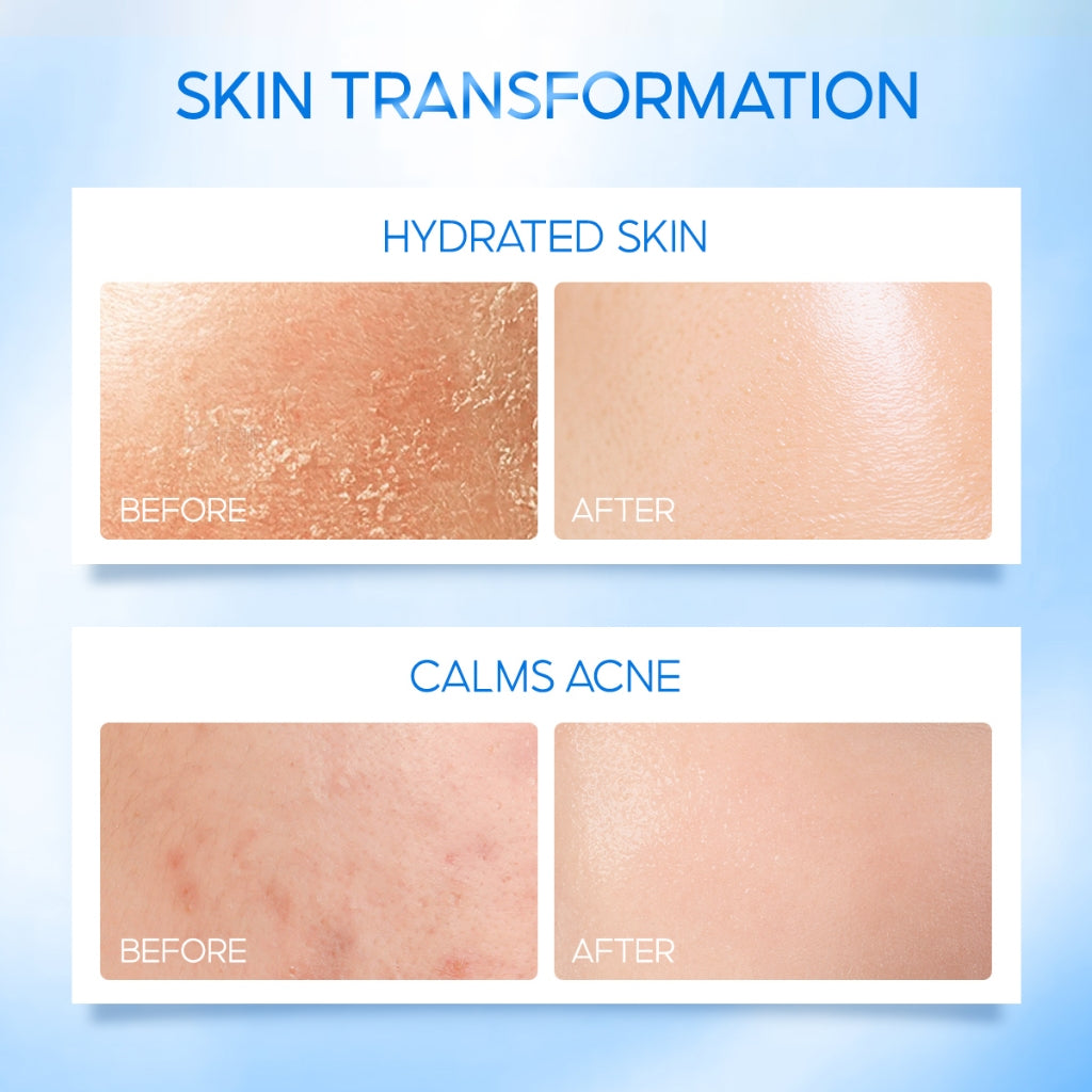ELFORMULA Intensive CeraHydro Barrier Repair Moisture Gel - Moisturizer Calming Pelembab Wajah Pagi Malam Kulit Cerah Skin Barrier Hyaluronic Acid with CeraHydro + Plant Extract & Ceramide Skincare Oil Control Kulit Kering Iritasi