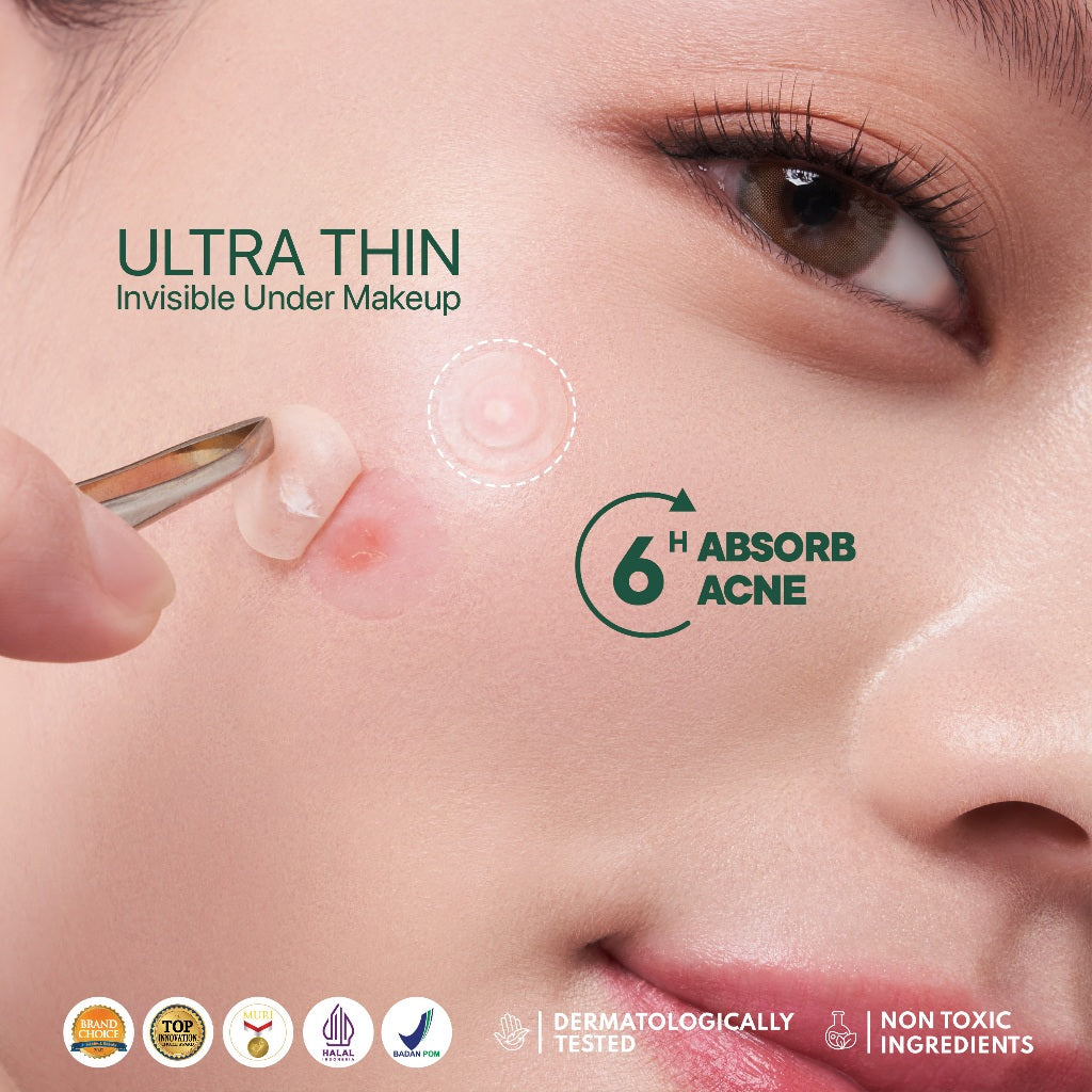 ACNE PATCH - NPURE Acne Clear Patch isi 18Pcs / Ultra thin layer / Patch Jerawat / Acne Skin / Untuk kulit Berjerawat