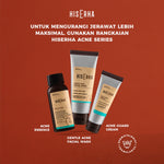 HIS ERHA Gentle Acne Facial Wash 100g - Sabun Cuci Muka Pria untuk Membantu Lawan Jerawat, Kontrol Minyak Berlebih, Lembap, Tanpa Rasa Ketarik, Tanpa Iritasi, Wangi Segar Maskulin, Verified by Dermatologist, Salicylic Acid, Zinc PCA, Gentle Scrub