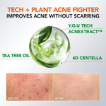 [NEW] YOU AcnePlus 2% BHA Fight Acne Serum Jerawat Kulit Berminyak Berjerawat Salicylic Acid Serum